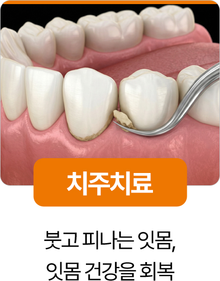 디디치과 치주치료 잇몸 건강 회복