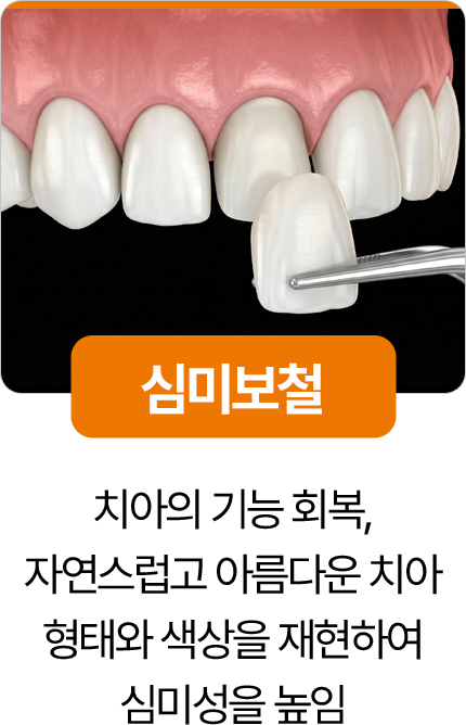 디디치과 심미보철 치아 기능과 심미성 회복