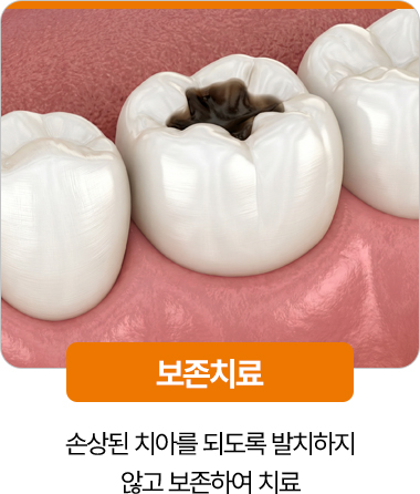 디디치과 보존치료 손상 치아 보존