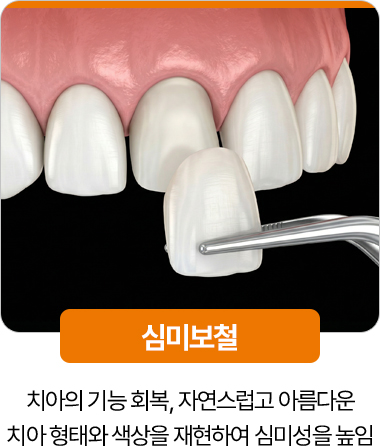 디디치과 심미보철 치아 기능과 심미성 회복